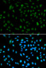 Immunofluorescence analysis of A549 cells using WHSC1L1 antibody (19-743) . Blue: DAPI for nuclear staining.