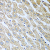 Immunohistochemistry of paraffin-embedded human liver using Eif2ak2 antibody (19-744) at dilution of 1:100 (40x lens) .