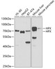 Western blot analysis of extracts of various cell lines, using HPX antibody (19-752) at 1:1000 dilution.<br/>Secondary antibody: HRP Goat Anti-Rabbit IgG (H+L) at 1:10000 dilution.<br/>Lysates/proteins: 25ug per lane.<br/>Blocking buffer: 3% nonfat dry milk in TBST.<br/>Detection: ECL Basic Kit.<br/>Exposure time: 90s.