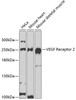 Western blot analysis of extracts of various cell lines, using VEGF Receptor 2 antibody (19-754) at 1:1000 dilution.<br/>Secondary antibody: HRP Goat Anti-Rabbit IgG (H+L) at 1:10000 dilution.<br/>Lysates/proteins: 25ug per lane.<br/>Blocking buffer: 3% nonfat dry milk in TBST.<br/>Detection: ECL Basic Kit.<br/>Exposure time: 20s.