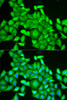 Immunofluorescence analysis of HeLa cells using RAB6A antibody (19-755) . Blue: DAPI for nuclear staining.