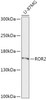 Western blot analysis of extracts of U-87MG cells, using ROR2 antibody (19-761) at 1:1000 dilution.<br/>Secondary antibody: HRP Goat Anti-Rabbit IgG (H+L) at 1:10000 dilution.<br/>Lysates/proteins: 25ug per lane.<br/>Blocking buffer: 3% nonfat dry milk in TBST.<br/>Detection: ECL Basic Kit.<br/>Exposure time: 3MIN.