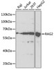 Western blot analysis of extracts of various cell lines, using RAG2 antibody (19-764) at 1:1000 dilution.<br/>Secondary antibody: HRP Goat Anti-Rabbit IgG (H+L) at 1:10000 dilution.<br/>Lysates/proteins: 25ug per lane.<br/>Blocking buffer: 3% nonfat dry milk in TBST.<br/>Detection: ECL Basic Kit.<br/>Exposure time: 90s.