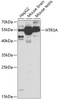 Western blot analysis of extracts of various cell lines, using HTR3A antibody (19-776) at 1:1000 dilution.<br/>Secondary antibody: HRP Goat Anti-Rabbit IgG (H+L) at 1:10000 dilution.<br/>Lysates/proteins: 25ug per lane.<br/>Blocking buffer: 3% nonfat dry milk in TBST.<br/>Detection: ECL Enhanced Kit.<br/>Exposure time: 30s.