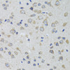 Immunohistochemistry of paraffin-embedded rat brain using HTR3A antibody (19-776) at dilution of 1:100 (40x lens) .