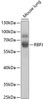 Western blot analysis of extracts of mouse lung, using RBPJ antibody (19-786) at 1:1000 dilution.<br/>Secondary antibody: HRP Goat Anti-Rabbit IgG (H+L) at 1:10000 dilution.<br/>Lysates/proteins: 25ug per lane.<br/>Blocking buffer: 3% nonfat dry milk in TBST.<br/>Detection: ECL Basic Kit.<br/>Exposure time: 90s.