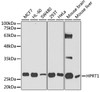 Western blot analysis of extracts of various cell lines, using HPRT1 antibody (19-798) at 1:1000 dilution.<br/>Secondary antibody: HRP Goat Anti-Rabbit IgG (H+L) at 1:10000 dilution.<br/>Lysates/proteins: 25ug per lane.<br/>Blocking buffer: 3% nonfat dry milk in TBST.<br/>Detection: ECL Basic Kit.<br/>Exposure time: 60s.