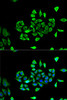 Immunofluorescence analysis of U2OS cells using CLCN5 antibody (19-806) . Blue: DAPI for nuclear staining.