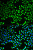 Immunofluorescence analysis of MCF-7 cells using CS antibody (19-809) . Blue: DAPI for nuclear staining.