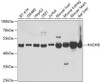 Western blot analysis of extracts of various cell lines, using HADHB antibody (19-811) at 1:1000 dilution.<br/>Secondary antibody: HRP Goat Anti-Rabbit IgG (H+L) at 1:10000 dilution.<br/>Lysates/proteins: 25ug per lane.<br/>Blocking buffer: 3% nonfat dry milk in TBST.<br/>Detection: ECL Enhanced Kit.<br/>Exposure time: 90s.