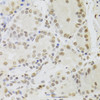 Immunohistochemistry of paraffin-embedded human stomach using RUVBL1 Antibody (19-815) at dilution of 1:100 (40x lens) .