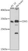 Western blot analysis of extracts of various cell lines, using CDK5 antibody (19-820) at 1:1000 dilution.<br/>Secondary antibody: HRP Goat Anti-Rabbit IgG (H+L) at 1:10000 dilution.<br/>Lysates/proteins: 25ug per lane.<br/>Blocking buffer: 3% nonfat dry milk in TBST.<br/>Detection: ECL Basic Kit.<br/>Exposure time: 90s.