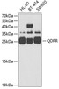 Western blot analysis of extracts of various cell lines, using QDPR antibody (19-822) at 1:3000 dilution._Secondary antibody: HRP Goat Anti-Rabbit IgG (H+L) at 1:10000 dilution._Lysates/proteins: 25ug per lane._Blocking buffer: 3% nonfat dry milk in TBST._Detection: ECL Enhanced Kit._Exposure time: 90s.