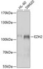 Western blot analysis of extracts of various cell lines, using EZH2 antibody (19-829) at 1:1000 dilution.<br/>Secondary antibody: HRP Goat Anti-Rabbit IgG (H+L) at 1:10000 dilution.<br/>Lysates/proteins: 25ug per lane.<br/>Blocking buffer: 3% nonfat dry milk in TBST.<br/>Detection: ECL Basic Kit.<br/>Exposure time: 1s.