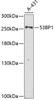 Western blot analysis of extracts of A-431 cells, using 53BP1 antibody (19-839) at 1:1000 dilution.<br/>Secondary antibody: HRP Goat Anti-Rabbit IgG (H+L) at 1:10000 dilution.<br/>Lysates/proteins: 25ug per lane.<br/>Blocking buffer: 3% nonfat dry milk in TBST.<br/>Detection: ECL Enhanced Kit.<br/>Exposure time: 40s.