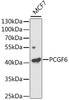 Western blot analysis of extracts of MCF7 cells, using PCGF6 antibody (19-841) at 1:1000 dilution.<br/>Secondary antibody: HRP Goat Anti-Rabbit IgG (H+L) at 1:10000 dilution.<br/>Lysates/proteins: 25ug per lane.<br/>Blocking buffer: 3% nonfat dry milk in TBST.<br/>Detection: ECL Enhanced Kit.<br/>Exposure time: 120s.