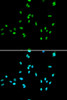 Immunofluorescence analysis of A549 cells using NR5A2 antibody (19-844) . Blue: DAPI for nuclear staining.