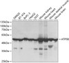 Western blot analysis of extracts of various cell lines, using ATP5B Antibody (19-846) at 1:1000 dilution.<br/>Secondary antibody: HRP Goat Anti-Rabbit IgG (H+L) at 1:10000 dilution.<br/>Lysates/proteins: 25ug per lane.<br/>Blocking buffer: 3% nonfat dry milk in TBST.<br/>Detection: ECL Basic Kit.<br/>Exposure time: 3s.