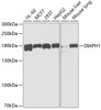 Western blot analysis of extracts of various cell lines, using DIAPH1 antibody (19-849) at 1:1000 dilution.<br/>Secondary antibody: HRP Goat Anti-Rabbit IgG (H+L) at 1:10000 dilution.<br/>Lysates/proteins: 25ug per lane.<br/>Blocking buffer: 3% nonfat dry milk in TBST.<br/>Detection: ECL Basic Kit.<br/>Exposure time: 90s.