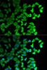 Immunofluorescence analysis of U2OS cells using DIAPH1 antibody (19-849) . Blue: DAPI for nuclear staining.