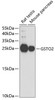 Western blot analysis of extracts of various cell lines, using GSTO2 antibody (19-850) at 1:1000 dilution.<br/>Secondary antibody: HRP Goat Anti-Rabbit IgG (H+L) at 1:10000 dilution.<br/>Lysates/proteins: 25ug per lane.<br/>Blocking buffer: 3% nonfat dry milk in TBST.<br/>Detection: ECL Basic Kit.<br/>Exposure time: 90s.