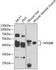 Western blot analysis of extracts of various cell lines, using NFKBIB antibody (19-852) at 1:1000 dilution._Secondary antibody: HRP Goat Anti-Rabbit IgG (H+L) at 1:10000 dilution._Lysates/proteins: 25ug per lane._Blocking buffer: 3% nonfat dry milk in TBST._Detection: ECL Enhanced Kit._Exposure time: 30s.