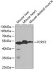 Western blot analysis of extracts of various cell lines, using P2RY2 antibody (19-854) at 1:1000 dilution.<br/>Secondary antibody: HRP Goat Anti-Rabbit IgG (H+L) at 1:10000 dilution.<br/>Lysates/proteins: 25ug per lane.<br/>Blocking buffer: 3% nonfat dry milk in TBST.
