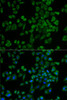Immunofluorescence analysis of U2OS cells using P2RY2 antibody (19-854) . Blue: DAPI for nuclear staining.
