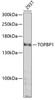 Western blot analysis of extracts of 293T cells, using TOPBP1 antibody (19-856) at 1:1000 dilution._Secondary antibody: HRP Goat Anti-Rabbit IgG (H+L) at 1:10000 dilution._Lysates/proteins: 25ug per lane._Blocking buffer: 3% nonfat dry milk in TBST._Detection: ECL Enhanced Kit._Exposure time: 50s.