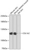 Western blot analysis of extracts of various cell lines, using COL1A2 antibody (19-858) at 1:1000 dilution.<br/>Secondary antibody: HRP Goat Anti-Rabbit IgG (H+L) at 1:10000 dilution.<br/>Lysates/proteins: 25ug per lane.<br/>Blocking buffer: 3% nonfat dry milk in TBST.<br/>Detection: ECL Basic Kit.<br/>Exposure time: 90s.