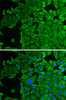 Immunofluorescence analysis of HeLa cells using p53 antibody (19-867) . Blue: DAPI for nuclear staining.