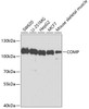Western blot analysis of extracts of various cell lines, using COMP antibody (19-873) at 1:1000 dilution.<br/>Secondary antibody: HRP Goat Anti-Rabbit IgG (H+L) at 1:10000 dilution.<br/>Lysates/proteins: 25ug per lane.<br/>Blocking buffer: 3% nonfat dry milk in TBST.<br/>Detection: ECL Enhanced Kit.<br/>Exposure time: 60s.