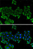 Immunofluorescence analysis of U2OS cells using COMP antibody (19-873) . Blue: DAPI for nuclear staining.