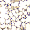 Immunohistochemistry of paraffin-embedded mouse lung using CXXC1 antibody (19-875) at dilution of 1:200 (40x lens) .