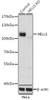 Western blot analysis of extracts from normal (control) and HELLS knockout (KO) HeLa cells, using HELLS antibody (19-887) at 1:1000 dilution.<br/>Secondary antibody: HRP Goat Anti-Rabbit IgG (H+L) at 1:10000 dilution.<br/>Lysates/proteins: 25ug per lane.<br/>Blocking buffer: 3% nonfat dry milk in TBST.<br/>Detection: ECL Basic Kit.<br/>Exposure time: 5s.