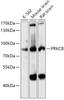 Western blot analysis of extracts of various cell lines, using PRKCB antibody (19-895) at 1:3000 dilution.<br/>Secondary antibody: HRP Goat Anti-Rabbit IgG (H+L) at 1:10000 dilution.<br/>Lysates/proteins: 25ug per lane.<br/>Blocking buffer: 3% nonfat dry milk in TBST.<br/>Detection: ECL Basic Kit.<br/>Exposure time: 10s.