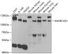 Western blot analysis of extracts of various cell lines, using SMARCAD1 antibody (19-898) at 1:1000 dilution.<br/>Secondary antibody: HRP Goat Anti-Rabbit IgG (H+L) at 1:10000 dilution.<br/>Lysates/proteins: 25ug per lane.<br/>Blocking buffer: 3% nonfat dry milk in TBST.<br/>Detection: ECL Basic Kit.<br/>Exposure time: 90s.