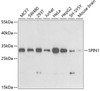 Western blot analysis of extracts of various cell lines, using SPIN1 antibody (19-899) at 1:1000 dilution.<br/>Secondary antibody: HRP Goat Anti-Rabbit IgG (H+L) at 1:10000 dilution.<br/>Lysates/proteins: 25ug per lane.<br/>Blocking buffer: 3% nonfat dry milk in TBST.<br/>Detection: ECL Basic Kit.<br/>Exposure time: 90s.