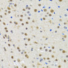 Immunohistochemistry of paraffin-embedded rat brain using SPIN1 antibody (19-899) at dilution of 1:100 (40x lens) .