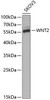 Western blot analysis of extracts of SKOV3 cells, using WNT2 Antibody (19-905) at 1:1000 dilution._Secondary antibody: HRP Goat Anti-Rabbit IgG (H+L) at 1:10000 dilution._Lysates/proteins: 25ug per lane._Blocking buffer: 3% nonfat dry milk in TBST._Detection: ECL Enhanced Kit._Exposure time: 60s.