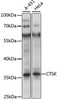 Western blot analysis of extracts of various cell lines, using CTSK antibody (19-908) at 1:1000 dilution.<br/>Secondary antibody: HRP Goat Anti-Rabbit IgG (H+L) at 1:10000 dilution.<br/>Lysates/proteins: 25ug per lane.<br/>Blocking buffer: 3% nonfat dry milk in TBST.<br/>Detection: ECL Enhanced Kit.<br/>Exposure time: 3s.