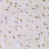 Immunohistochemistry of paraffin-embedded rat brain using ILF2 Antibody (19-916) at dilution of 1:100 (40x lens) .