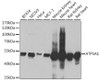 Western blot analysis of extracts of various cell lines, using ATP5A1 Antibody (19-918) at 1:1000 dilution.<br/>Secondary antibody: HRP Goat Anti-Rabbit IgG (H+L) at 1:10000 dilution.<br/>Lysates/proteins: 25ug per lane.<br/>Blocking buffer: 3% nonfat dry milk in TBST.<br/>Detection: ECL Basic Kit.<br/>Exposure time: 1s.