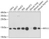 Western blot analysis of extracts of various cell lines, using RPS12 antibody (19-924) at 1:1000 dilution.<br/>Secondary antibody: HRP Goat Anti-Rabbit IgG (H+L) at 1:10000 dilution.<br/>Lysates/proteins: 25ug per lane.<br/>Blocking buffer: 3% nonfat dry milk in TBST.<br/>Detection: ECL Basic Kit.<br/>Exposure time: 15s.