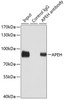 Immunoprecipitation analysis of 100ug extracts of SW480 cells using 3ug APEH antibody (19-927) . Western blot was performed from the immunoprecipitate using APEH antibody (19-927) at a dilition of 1:1000.