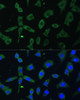 Immunofluorescence analysis of L-929 cells using EIF3D antibody (19-956) at dilution of 1:100. Blue: DAPI for nuclear staining.
