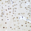 Immunohistochemistry of paraffin-embedded mouse brain using UTP14A antibody (19-960) at dilution of 1:100 (40x lens) .