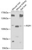 Western blot analysis of extracts of various cell lines, using POP1 antibody (19-961) at 1:1000 dilution.<br/>Secondary antibody: HRP Goat Anti-Rabbit IgG (H+L) at 1:10000 dilution.<br/>Lysates/proteins: 25ug per lane.<br/>Blocking buffer: 3% nonfat dry milk in TBST.<br/>Detection: ECL Basic Kit.<br/>Exposure time: 5s.