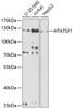 Western blot analysis of extracts of various cell lines, using HTATSF1 antibody (19-967) at 1:1000 dilution.<br/>Secondary antibody: HRP Goat Anti-Rabbit IgG (H+L) at 1:10000 dilution.<br/>Lysates/proteins: 25ug per lane.<br/>Blocking buffer: 3% nonfat dry milk in TBST.<br/>Detection: ECL Basic Kit.<br/>Exposure time: 90s.