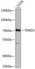 Western blot analysis of extracts of U2OS cells, using TDRD3 antibody (19-972) at 1:1000 dilution.<br/>Secondary antibody: HRP Goat Anti-Rabbit IgG (H+L) at 1:10000 dilution.<br/>Lysates/proteins: 25ug per lane.<br/>Blocking buffer: 3% nonfat dry milk in TBST.<br/>Detection: ECL Basic Kit.<br/>Exposure time: 90s.